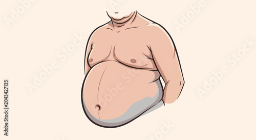 Illustration of a person's torso with significant abdominal girth and neck folds
