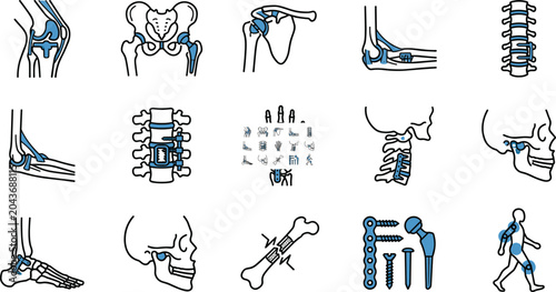 Konstfotografi Orthopedic anatomy and implant illustration set showing joints bones and surgica