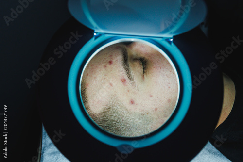 Bild auf Leinwand Cosmetology treatment in a skincare clinic with a client lying down for facial e