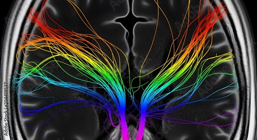 Colorful Neural Network Connections in Human Brain Scan with Transparent Background