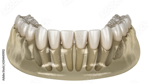 Canvastavla Human lower jaw with teeth and bone structure