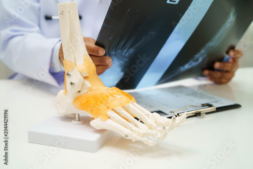 Schilderij op canvas Doctor examining foot ankle  joint bone radiography xray film.