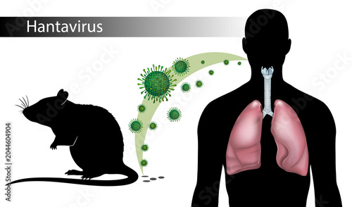 Hantavirus Transmission from Rodent to Human Respiratory System, Medical Vector Illustration of Airborne Infection. Hantavirus Pulmonary Syndrome Concept 