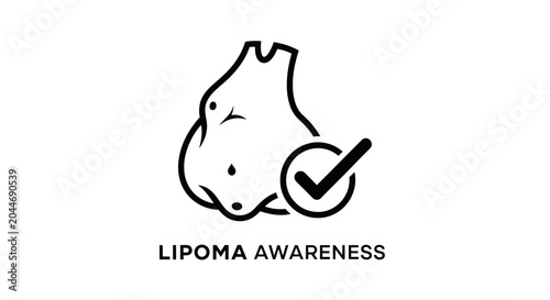 Illustrated Lipoma Awareness Symbol With Checkmark Graphic.