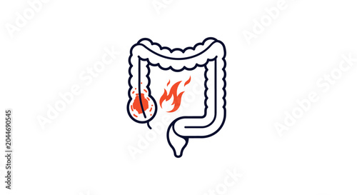 Illustrated inflamed human intestinal system outline.