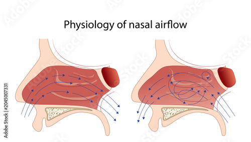Obraz na płótnie Physiology of Nasal Airflow
demonstrating normal and turbulent airflow patterns within the nasal cavity, highlighting the role of nasal turbinates in air conditioning and filtration