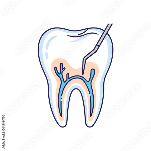 Dental care illustration: tooth cross-section with root canal treatment