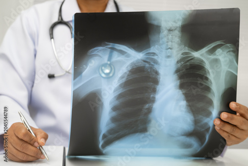Foto Doctor examining lung radiography xray film.