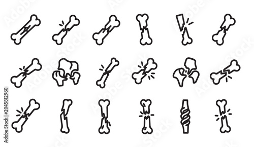 Various bone fracture icons in a clean line art style isolated on white