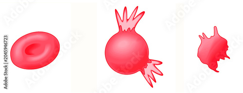 Foto Osmolarity effects on red blood cells.