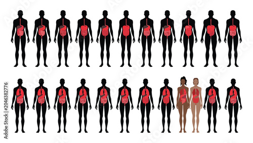 Cuadro en lienzo Human silhouettes arranged in a grid feature internal organ highlights to represent biological diversity and medical study