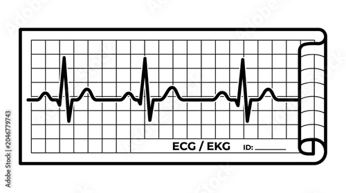 Electrocardiogram ECG Line Tracing on Medical Graph Paper Vector Illustration
