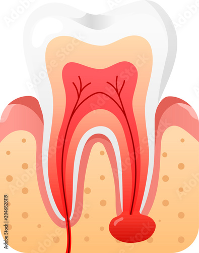 Quadro em tela Tooth dental root infection abscess gum anatomy oral cavity pain detailed tooth