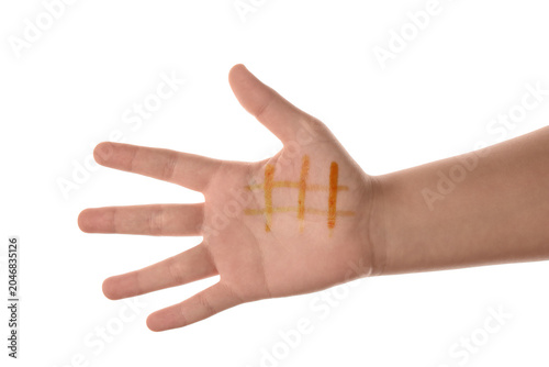 Female hand with iodine mes...