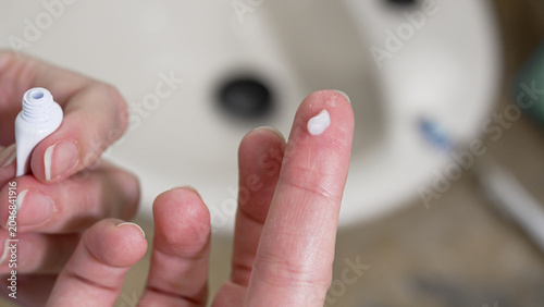 Photos Fingers dispensing a small amount of white dermatological cream from a tube onto