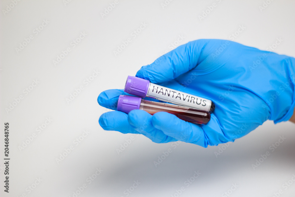 Obraz premium Hand in blue glove holds two test tubes. Blood samples labeled for viral testing. White background emphasizes medical precision. No faces show emotion, focus is clinical. Ideal for health, research