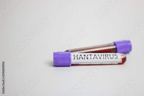 Foto Two test tubes with purple caps hold blood samples