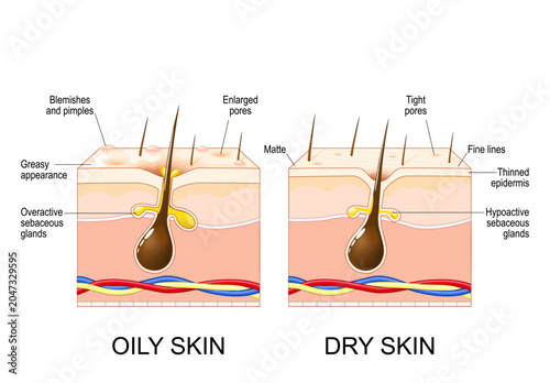 Foto Oily skin and dry skin comparison. Skin types.