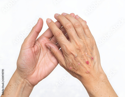 Two hands are shown, one young and one old, highlighting the contrast in their skin textures and the presence of red spots on the older hand