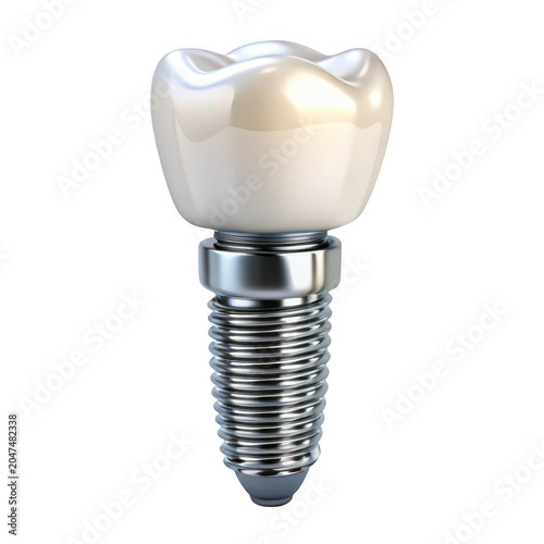 Dental implant with shiny metallic screw and white tooth