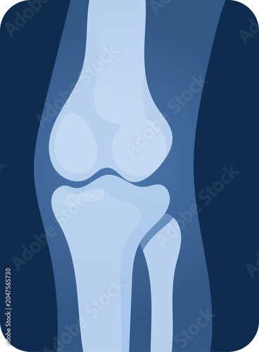 Tableau sur toile Knee joint bone anatomy medical illustration cartilage tibia femur fibula blue o