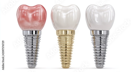Three dental implants with different crowns, two ceramic, one pink