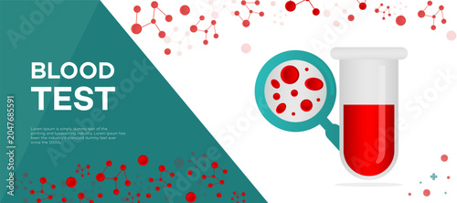 Bild auf Leinwand Illustrative design showcasing a blood test in a laboratory, featuring a test tube with blood and a magnifying glass revealing red blood cells