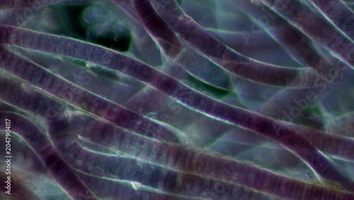 Foto Bangia sp. red algae filaments at 20x under darkfield microscopy