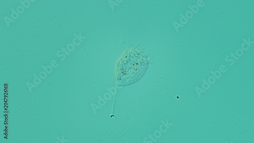 Photos Vorticella sp