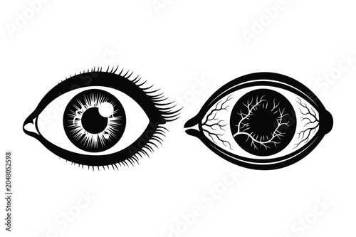 Принти на полотні Comparison illustration of healthy eye versus red bloodshot eye with eye care