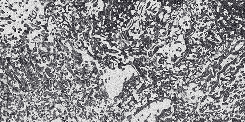 Detailed monochrome abstract texture resembling cellular structures or organic patterns with a grainy overlay and high contrast
