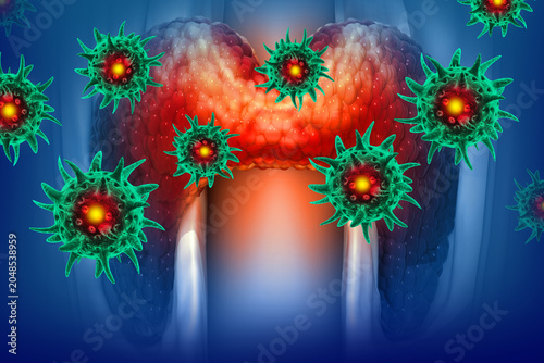 Virus infected thyroid gland. Thyroid disease concept. 3d illustration