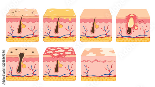 Bild auf Leinwand Vector set of human skin conditions and anatomical cross sections