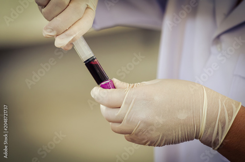 Nurse wearing white medical gloves is drawing blood from patient's arm for examination or PRP procedure. Concept of laboratory research, medicine, analysis.