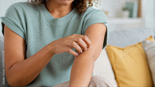 Woman scratching itchy arm, closeup of irritated skin and dry dermatological condition at home