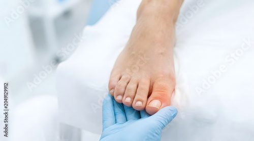 Medical professional supporting a woman's forefoot during a clinical examination, suitable for podiatry, foot pain, and treatment concepts
