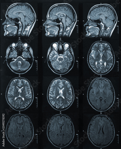 Medical Brain MRI Scans in Multiple Cross-Sectional Radiological Views