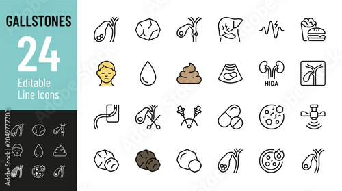 Bild auf Leinwand Gallstones and Gallbladder Disease Line Editable Icons set