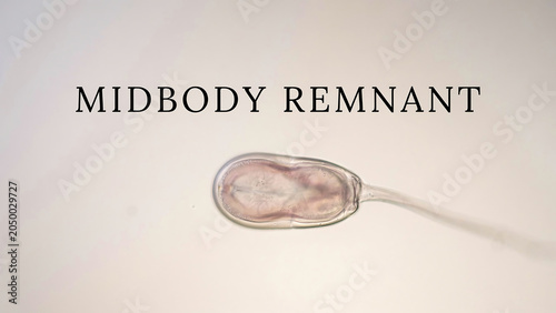 Midbody remnant cell division process structures  biology science education  cellular biology  microscopic view