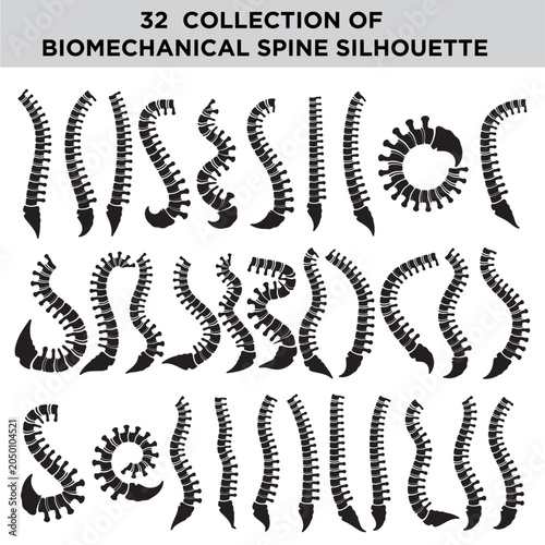 Human Spine Curvature Silhouettes Set, Spinal Column Deformity and Scoliosis Vector Icons