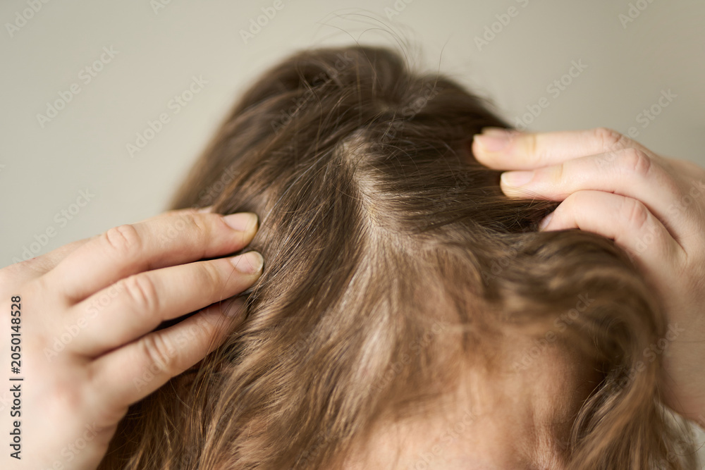 Naklejka premium Woman Examining Scalp Parting With Fingers To Reveal Thinning Roots In Indoor Neutral Setting, Closeup Of Brown Hair And Hands Near Forehead.