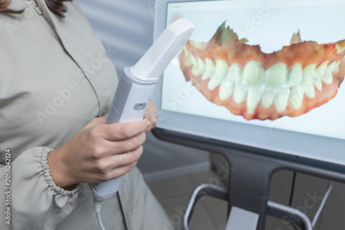 Bilde på lerret Las manos de dentistas escaneando sonrisa en Itero