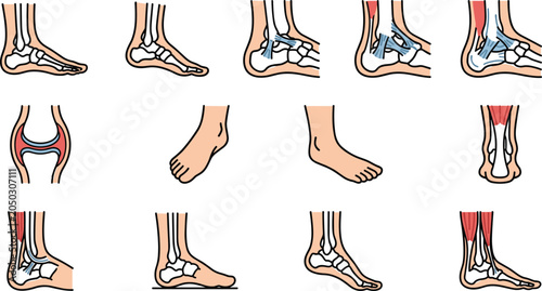 Bild auf Leinwand Anatomical illustrations of human foot and ankle joints set.