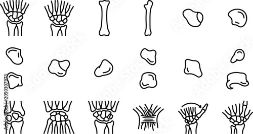 Fotografía Anatomy Illustration Showing Human Wrist and Hand Bone Structures