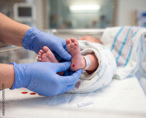 Nurse Conducting Newborn Heel Prick Test with Blood Spot Card