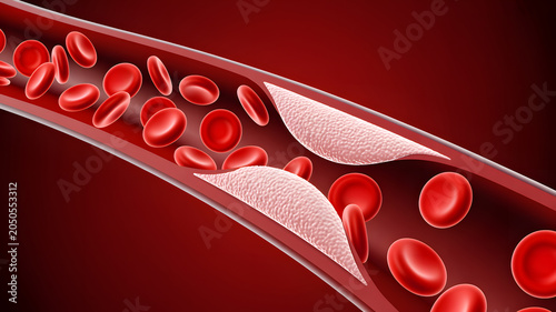 A medical illustration of red and white blood cells flowing through a blood vessel