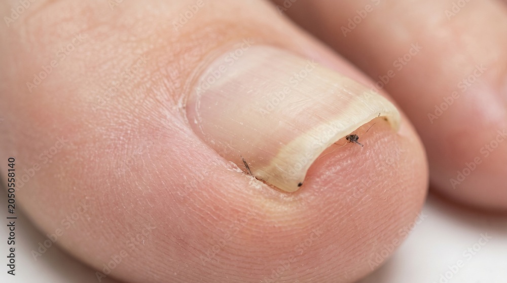 Fototapeta premium The Little Toenail: Involuted Nail Edge with Visible Cuticle and Proximal Fold