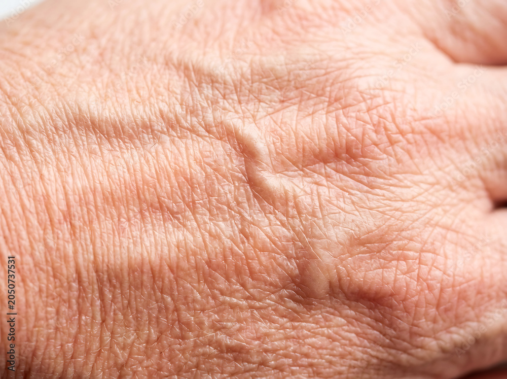 Fototapeta premium Close up of wrinkled aged skin texture with prominent veins elderly