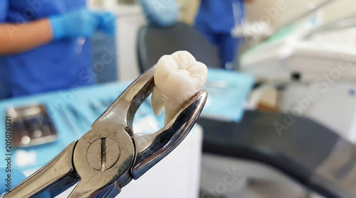 Tooth extraction procedure in dental clinic with tools and staff present