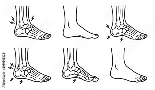 Human foot pain anatomy vector line icon set medical ankle ache arthritis concept illustration graphic design